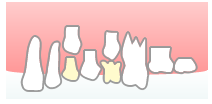 乳歯は永久歯に押し上げられて 自然に抜け落ちます。